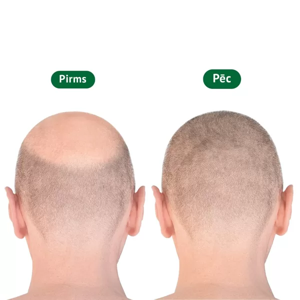 Pirms/pēc